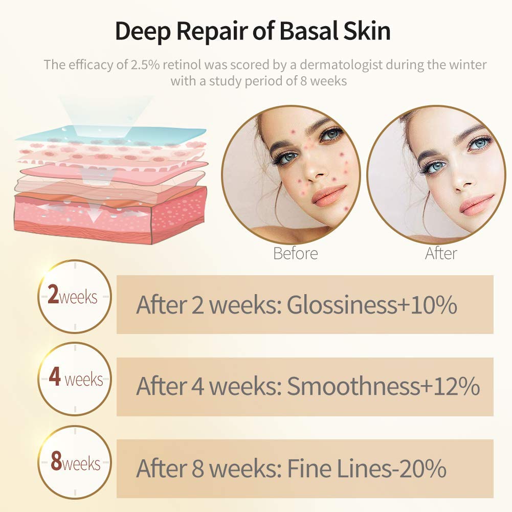 Retinol Serum,ETRONG High Strength Anti-aging Serum with 2.5% Retinol,Hyaluronic Acid and Vitamin E for Face Acne 1 Oz(30ml)