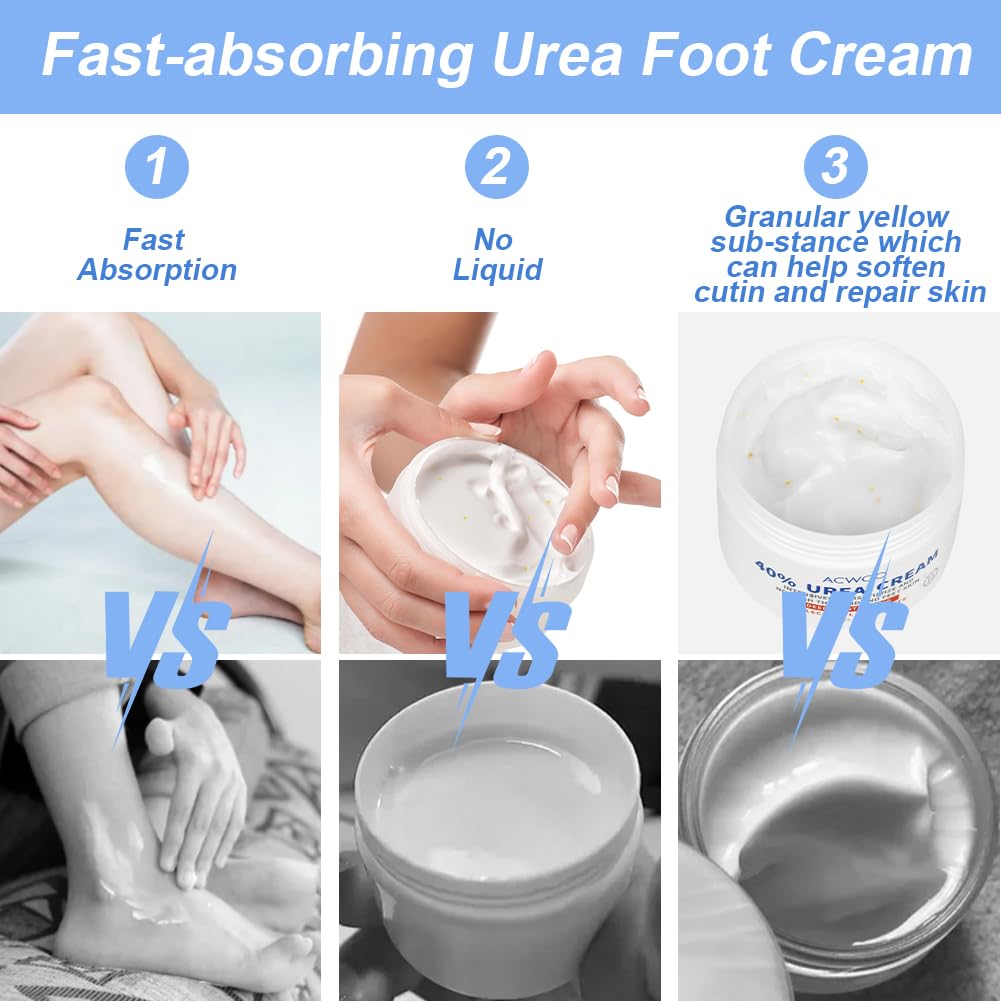 ACWOO Urea Cream 40%, Urea Foot Cream, 150g Urea Cream for Feet, Urea Foot & Hand Cream for Cracked Heels and Dry Skin, Foot Nourishing Frost for Callus Remover, 40% Urea Lotion for Feet