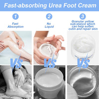 ACWOO Urea Cream 40%, Urea Foot Cream, 150g Urea Cream for Feet, Urea Foot & Hand Cream for Cracked Heels and Dry Skin, Foot Nourishing Frost for Callus Remover, 40% Urea Lotion for Feet