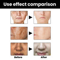 Dark Spots Correcting Facial Serum,2PCS Brightening Facial Serum,Rapid Dark Spot Correcting Serum,Improve Dry Skin & Smooth Skin,Brightening Serum,Dark Spot Remover Serum For Melanin Correcting