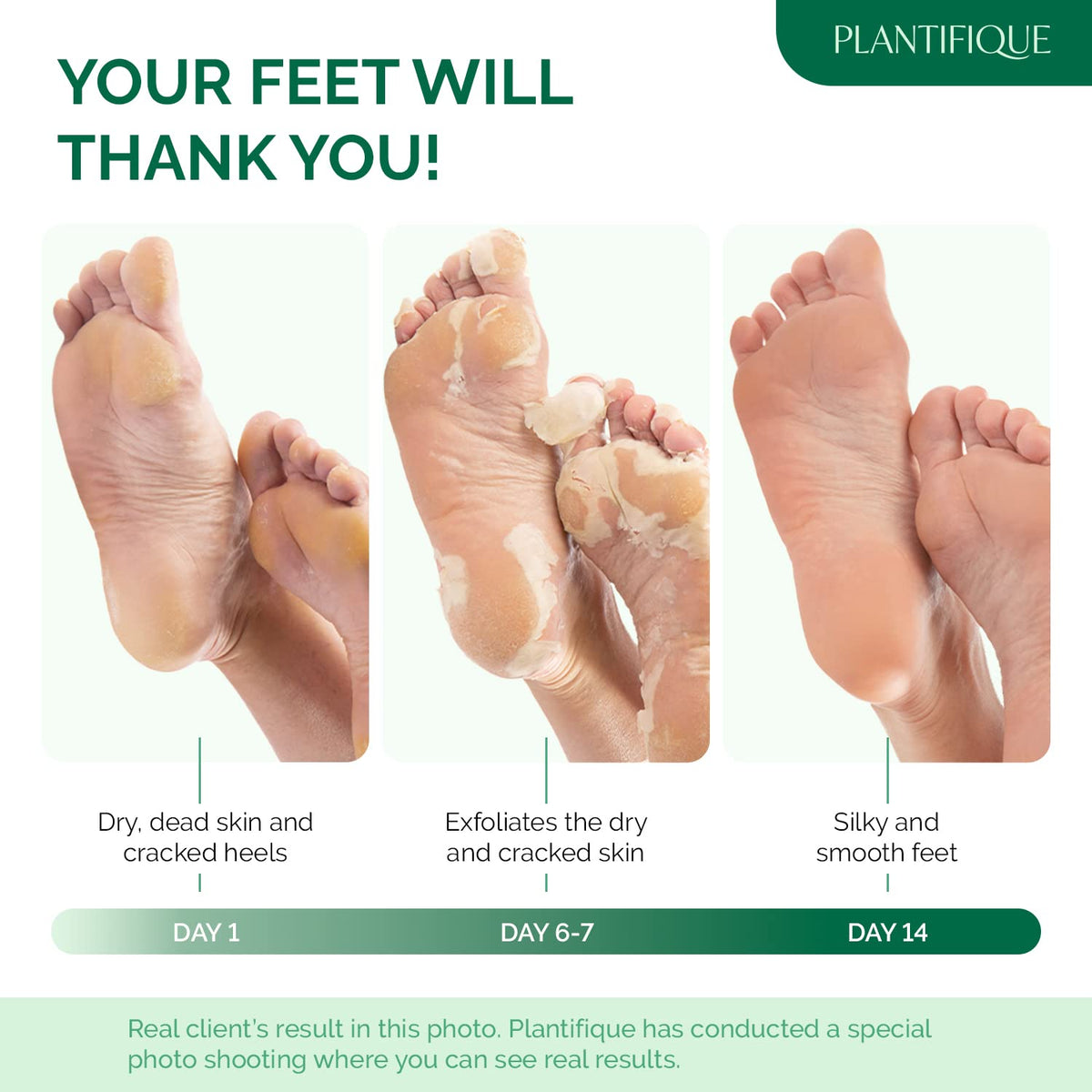 PLANTIFIQUE Plantifique Foot Peel Mask Foot Mask Dermatologically Tested Repair Heels & Removes Dry Dead Skin for Soft Baby Feet - Exfoliating Peel Mask for Hard Skin Peeling (Aloe Vera 2 Pack)