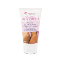 CARNATION FOOTCARE Cracked Heel Cream, Revives Rough, Dry and Cracked Heels, Moisturises, Rehydrates Dry Callused Feet with Refreshing Peppermint Oil with 20% Urea, 50ml