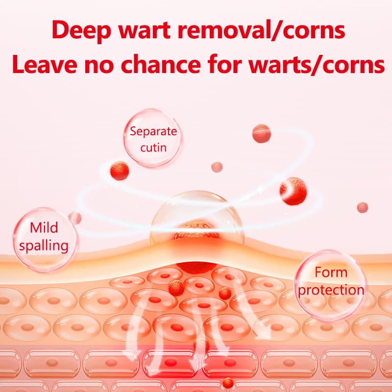 ERAYCEE Wart Remover, Wart Treatment Patch (42 Pieces), Plantar Wart Remover for Hands, Feet and Face, Wart Cream, Corn Remover, Deep Wart Removal Effective Pain Relief for Kids and Adults