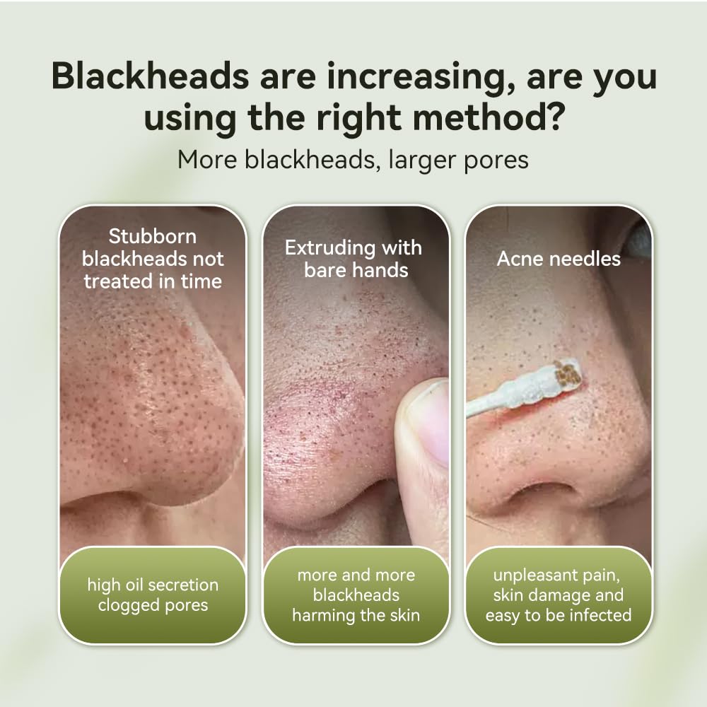 LANBENA Blackhead Remover Mask, Nose Plants Pore Strips Facial Cleanser, Peel off Mask Deep Cleansing for All Skin Types, 60 Pieces