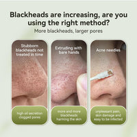 LANBENA Blackhead Remover Mask, Nose Plants Pore Strips Facial Cleanser, Peel off Mask Deep Cleansing for All Skin Types, 60 Pieces