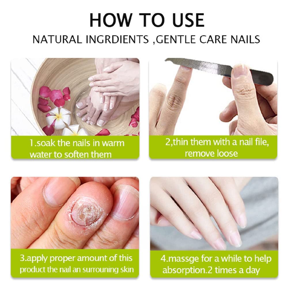 Nail Repair - Nail Treatment Repair Gel/Nail & Toenail Treatment Nail Repair Cream/Toe Be Health Instant Beauty Cream, Renews Yellow, Cracked, Damaged and Split Nails