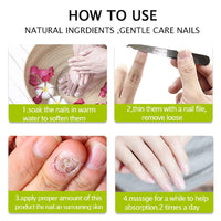 ZDHSOY Nail Repair - Nail Treatment Repair Gel/Nail & Toenail Treatment Nail Repair Cream/Toe Be Health Instant Beauty Cream, Renews Yellow, Cracked, Damaged and Split Nails