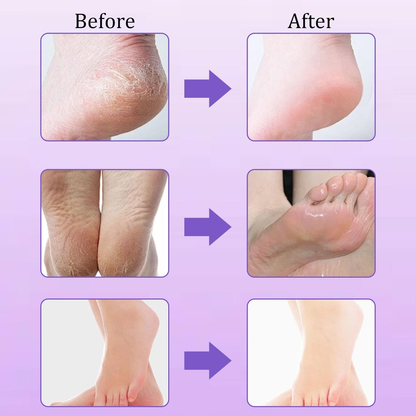 Nadiaen 4Pack Foot Peel Mask for Hard Skin, Exfoliating Foot Peel Mask, Callus Remover, Foot Care Mask for Cracked Heel, Dead & Dry Skin, Moisturizing Feet Peeling Mask for Women&Men - Lavender