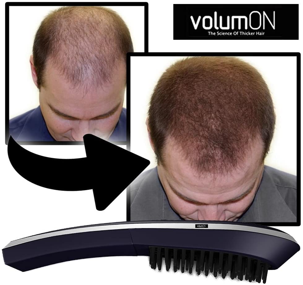 Volumon Hair Growth Brush VOLUMON® Hair Growth Treatment Laser Device to Help Prevent Further Hair Loss and Promote Hair Regrowth - Infrared Vibrating Massager with LCD Display for Men & Women