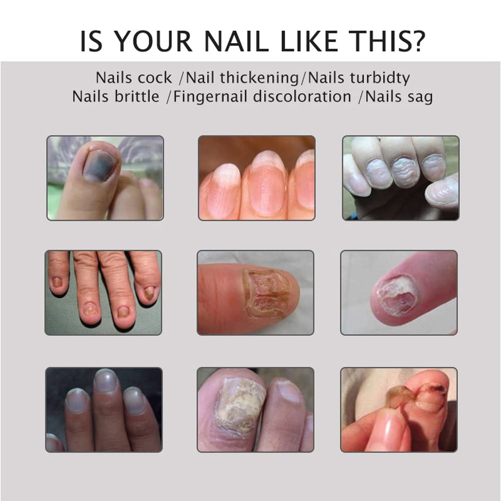 Nail Repair - Nail Treatment Repair Gel/Nail & Toenail Treatment Nail Repair Cream/Toe Be Health Instant Beauty Cream, Renews Yellow, Cracked, Damaged and Split Nails