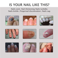 Nail Repair - Nail Treatment Repair Gel/Nail & Toenail Treatment Nail Repair Cream/Toe Be Health Instant Beauty Cream, Renews Yellow, Cracked, Damaged and Split Nails