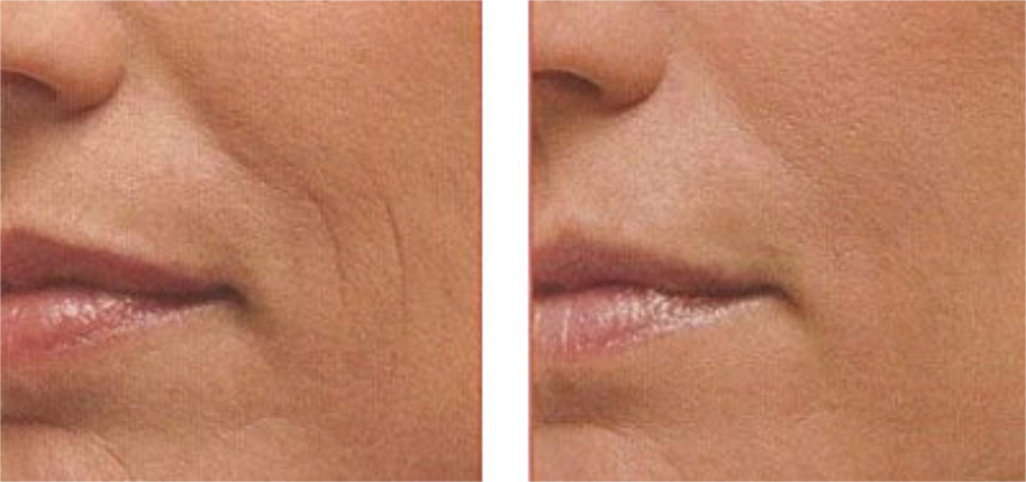 Galia Skincare POWERFUL Anti Aging Face Serum: Matrixyl 3000 + Argireline Peptide + Vitamin C Serum with Organic Hyaluronic Acid, Serum for Wrinkles, Fine Lines, Sun Spots, Most Powerful Triple Combination