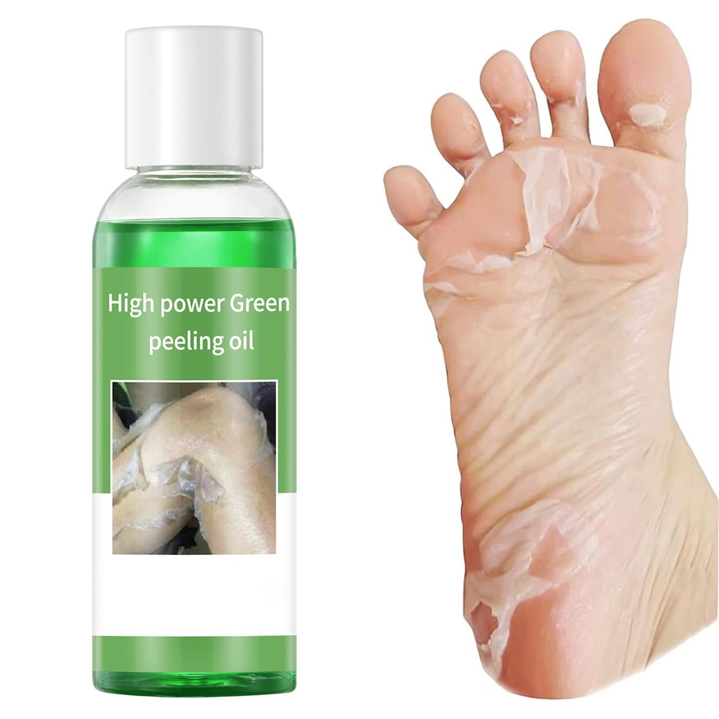 IREV Exfoliating Peeling Oil, Foot Peel Oil for Dry Dead Skin, Gentle Body Exfoliating for Women and Men
