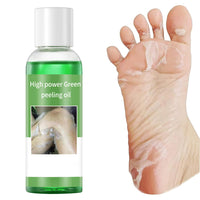 IREV Exfoliating Peeling Oil, Foot Peel Oil for Dry Dead Skin, Gentle Body Exfoliating for Women and Men