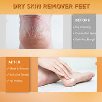 3pcs Moisturizing Hand & Foot Cream for Very Dry Skin - Cracked Heel Repair, Athletes Foot Care with Manuka Honey, Fast Absorption, Anti Dryness & Anti Crack, Portable Daily Size (1.41 oz)