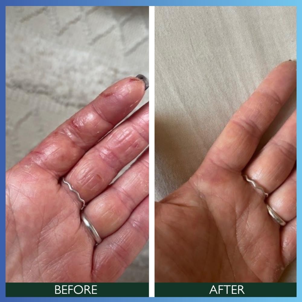 S SORTED Sorted Skin Intensive Rescue Moisturiser, Perfect for Dry, Dehydrated & Sensitive Skin, Intensive Hypoallergenic Body Moisturiser, Suitable for all Skin Conditions 1 x 100ml