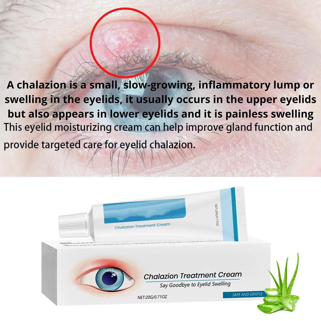 Mori Kamei Blepharitis Treatment Eye Cream，Eyelid Cream For Blepharitis,Chalazion Remover, Stye Eye Treatment,Used for Blepharitis Treatment, Swelling, Dry Eye （20g*Contains 1 pack of Cotton Swabs）