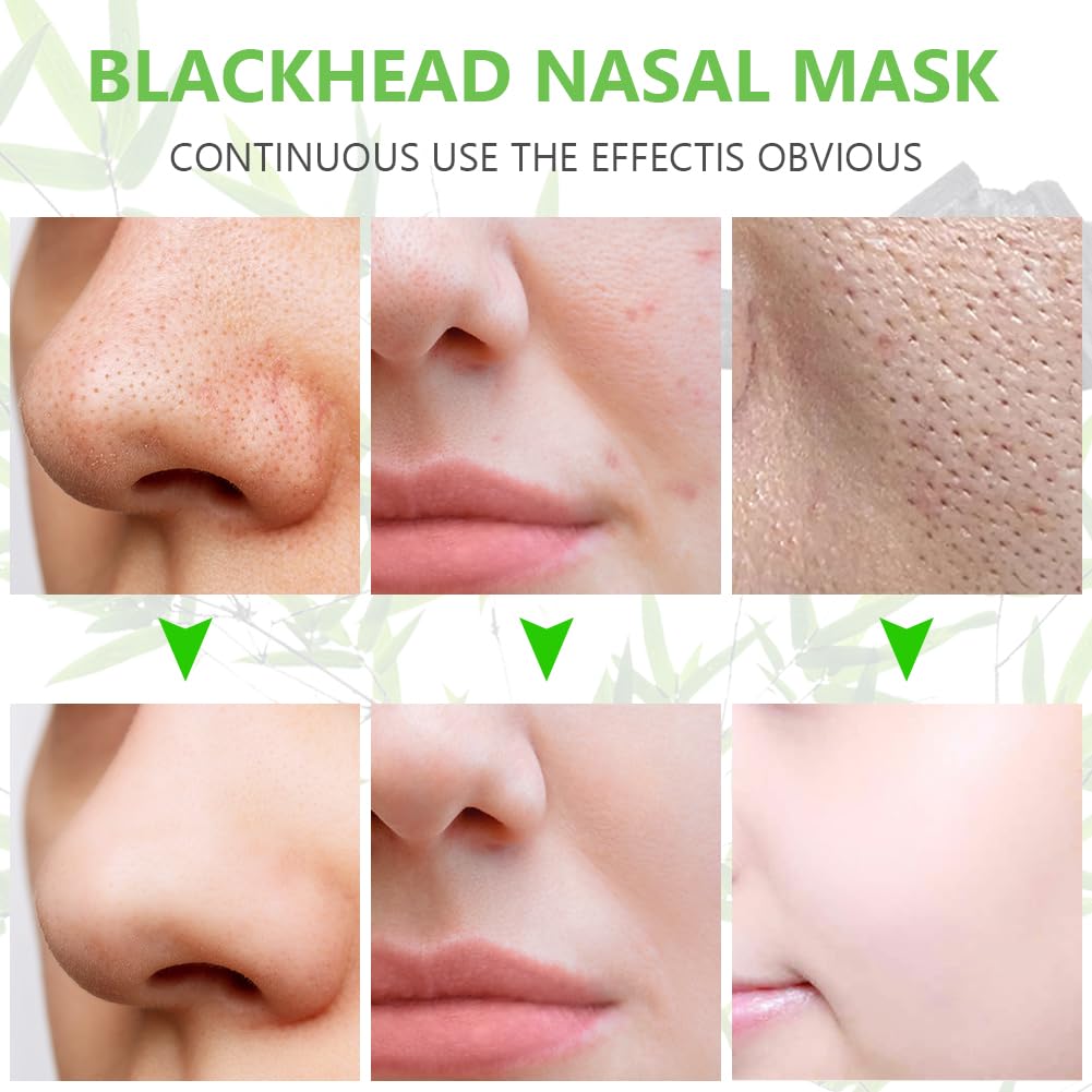 ACWOO Nose Strips, 60Pcs Pore Strips for Blackheads, Deep Cleansing Blackhead Remover Pore Strips, Nose Blackhead Remover Strips for Draws Out Dirt & Excess Oil, Helps Remove Impurities, Unclogs Pores