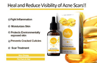 Vitamin E Oil Non Greasy Face Oil Treatment Dark Spots Face And Hair Oil Normal to Dry Skin Vitamin E Oil 50mL1.69oz By BELLE