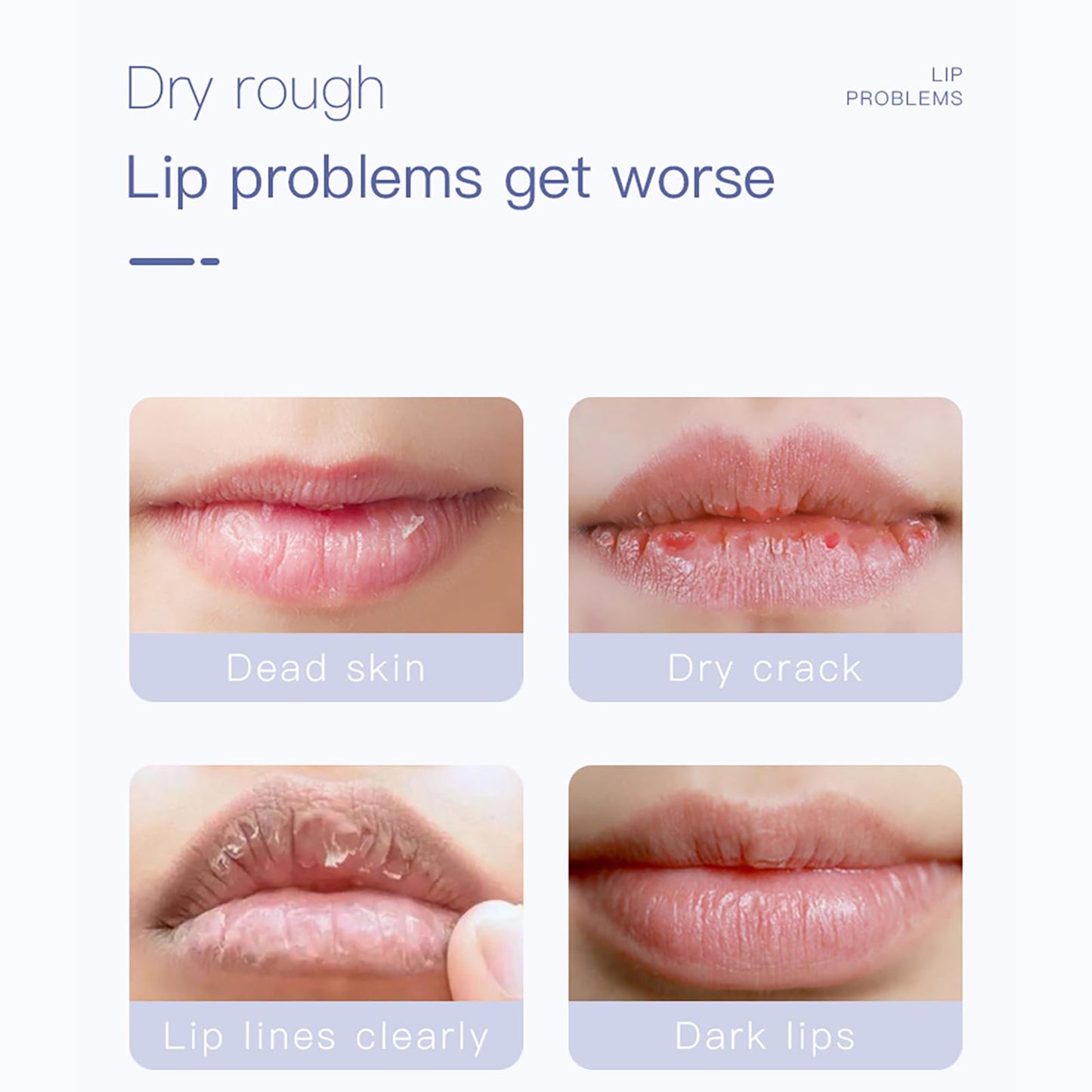 Lip Care Kit, MKNZOME Moisturizing Lip Mask & Lip Scrub Set,Exfoliating Lip Scrub Repair Lip Mask Lip Care Gift Women Girls Overnight Lip Treatment Repair for Dry Chapped Cracked Peel Lips, Lip Lines