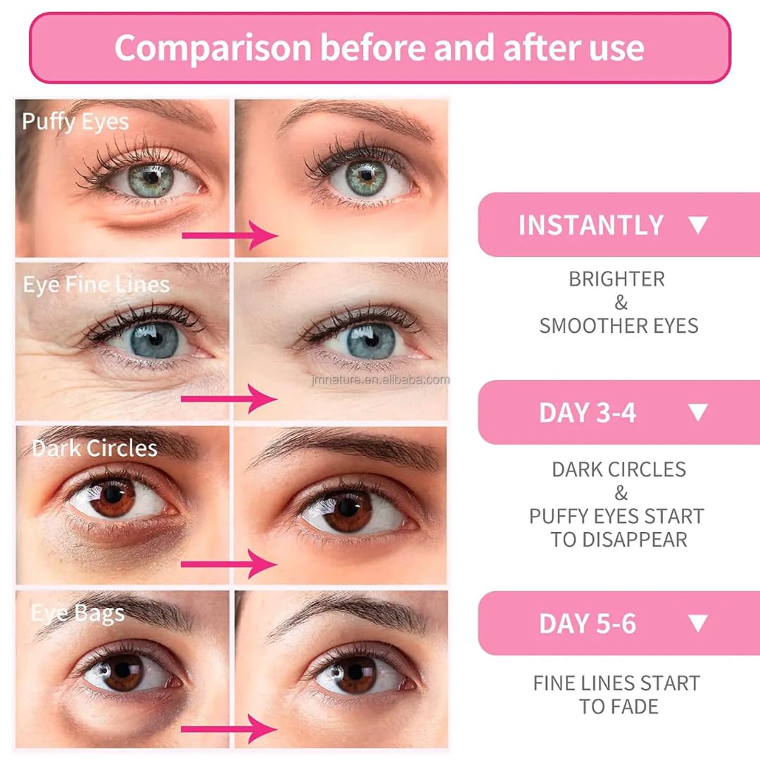 OVALA Rose Eye Mask - 60 Pcs Under Eye Treatment for Puffy Eyes, Wrinkles, Dark Circles and Fine Lines Skincare Eye Patch Masks for Women and Men