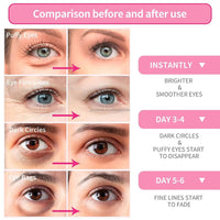 OVALA Rose Eye Mask - 60 Pcs Under Eye Treatment for Puffy Eyes, Wrinkles, Dark Circles and Fine Lines Skincare Eye Patch Masks for Women and Men