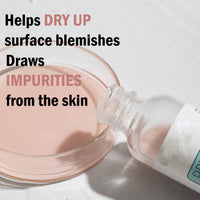 KAYZON Anti Acne Serum - Drying Lotion for Acne, Anti Acne Face Serum Dry Out Blemishes & Pimple Reduce Redness Acnecide Face Lotion for Teenage Girl Women Men Skin Care