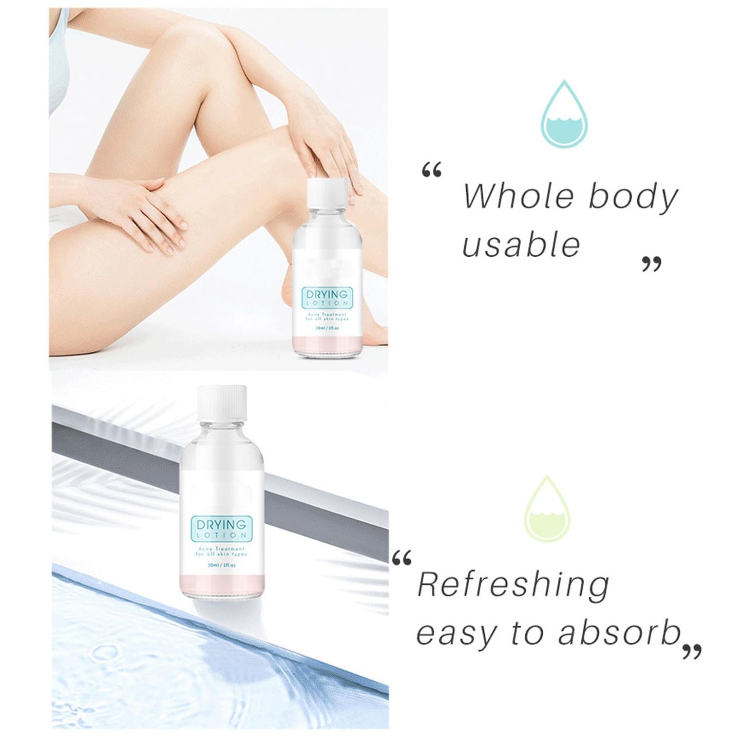 KAYZON Anti Acne Serum - Drying Lotion for Acne, Anti Acne Face Serum Dry Out Blemishes & Pimple Reduce Redness Acnecide Face Lotion for Teenage Girl Women Men Skin Care