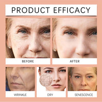 jinyue Paracress Facial Oil,Paracress Facial Oil Serum,Reduce Smooth Fine Lines And Wrinkles,Paracress Anti-Wrinkle Serum, Reduce Smooth Fine Lines and Wrinkles, for All Skin Types 60ml