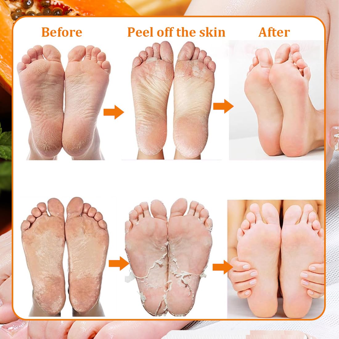 Tomedeks 4 Pairs Foot Peel mask for Hard Skin, Peeling Foot mask