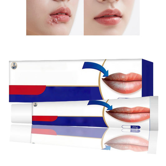 Cold Sore Cream,Cold Sore Treatment Cream,Mouth Ulcer Treatment for Adults,Gentle Sore Lips Treatment,Mouth Sore Treatment for Lips,Mouth Ulcer Gel,Fresh and Non-irritating,Natural Ingredients,20g