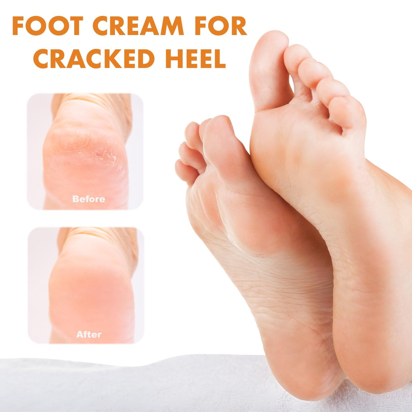 CTUBLIAUNX Foot Cream – Honey & Vitamin E Moisturizer, Cracked Heel Repair and Callus Softener for Extremely Dry Skin, Non-Greasy Deep Hydration for Rough Hands & Feet