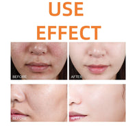 Orange Peeling Gel,Orange Enzymes Exfoliating Gel,Facial Scrub Exfoliating Cleanser,Deep E/xfoliating Cleanser,Face and Body Exfo/liating Scrub G/el,Whitening Deep Exfoliator,Facial Exfoliator