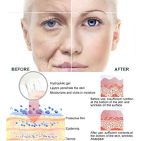 SEGMINISMART Nail Anti Wrinkle Patches 15ml