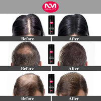 NM BEAUTY Hair Building Fiber Black & Dark Brown Fill Thinning & Fine Hair For Quickly Fuller Look Men & Barbers, 5 Seconds Cover Hair Loss Net WT. 0.97oz/27.5g by NM Beauty (Black)