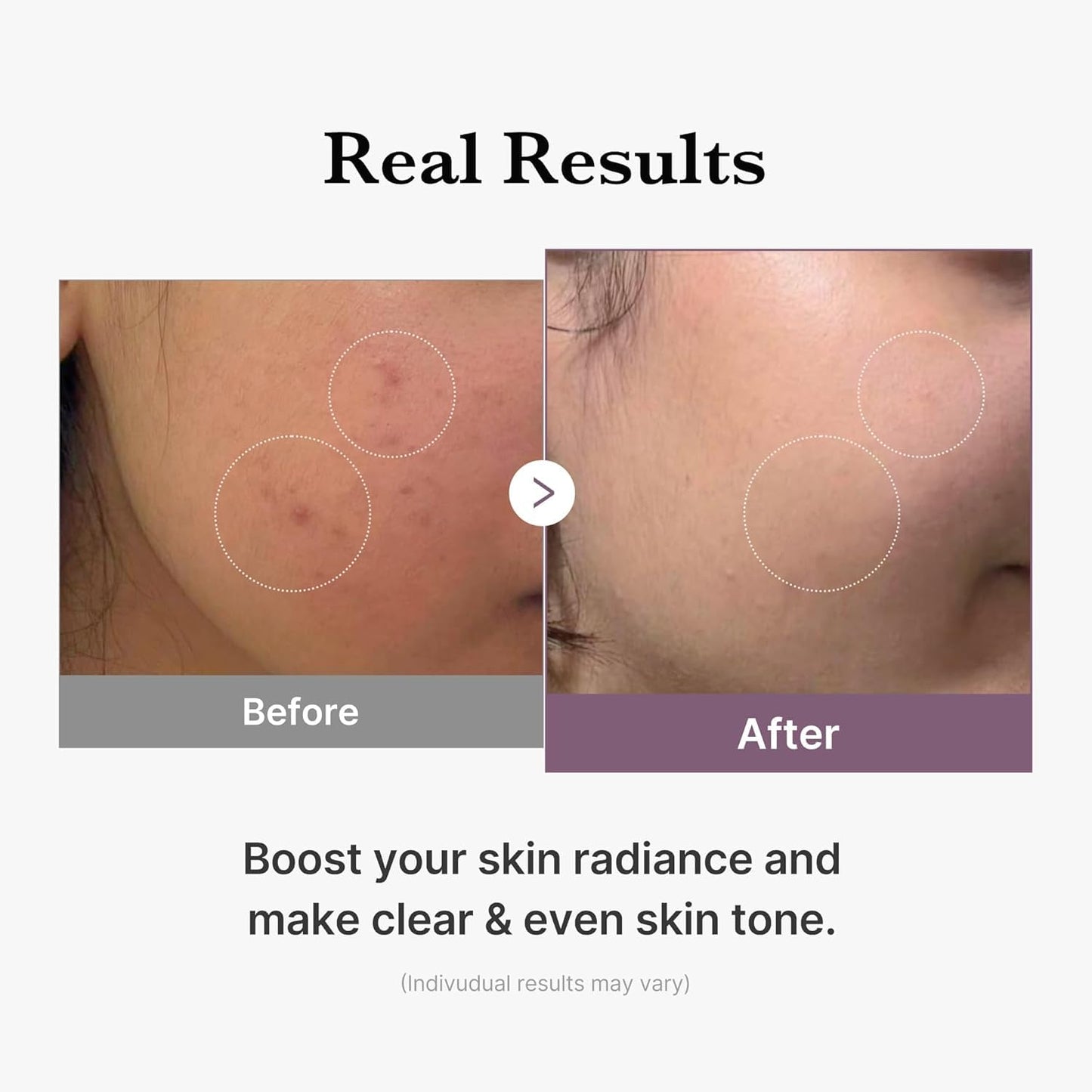 medicube Medicube Age-R Glutathione Glow Toner - Milky 2-Phase Toner with Peptides & Glutathione for Glass Skin Effect - Radiant, Hydrated Complexion - 140 ml