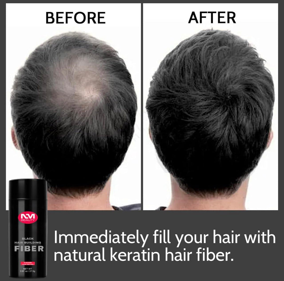 NM BEAUTY Hair Building Fiber Black & Dark Brown Fill Thinning & Fine Hair For Quickly Fuller Look Men & Barbers, 5 Seconds Cover Hair Loss Net WT. 0.97oz/27.5g by NM Beauty (Black)
