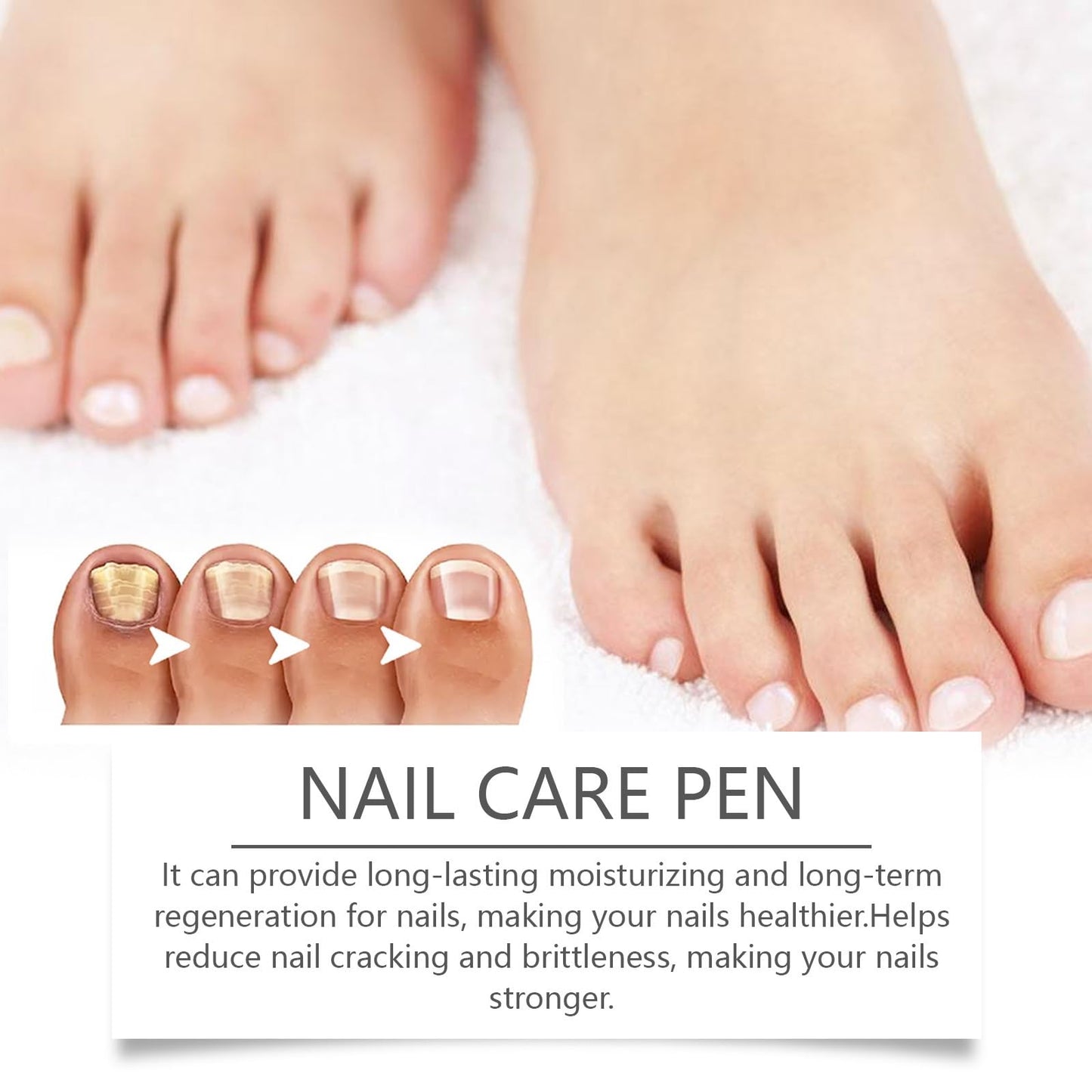 2PCS Nail Care Pen & Serum,Nail Revive Pen,Fungel Nail Treatmant Pe/n,Toena/il Fungas Treatmant P/en,To/enails Repair Pe/n,Nai/l Repair Essence for Toena/il and Fingernails,Fungel N/ail trea/tmant