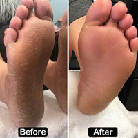 Electric Foot File Hard Skin Remover (Speed Adjustable) with 60pcs Replacement Sandpaper Disks, Professional Electric Callus Remover Pedicure Foot Scraper Hard Skin Remover (Pink)