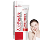 Whitening Freckle Cream,Moisturizing Removes Facial Dark Spots,Dark Spot Remover,Spot Removal Treatment Cream,Sp/ot Off Freck/le Whitening Crea/m,Anti wrinkle Moisturizing Fre/ckle Remover Cre/am