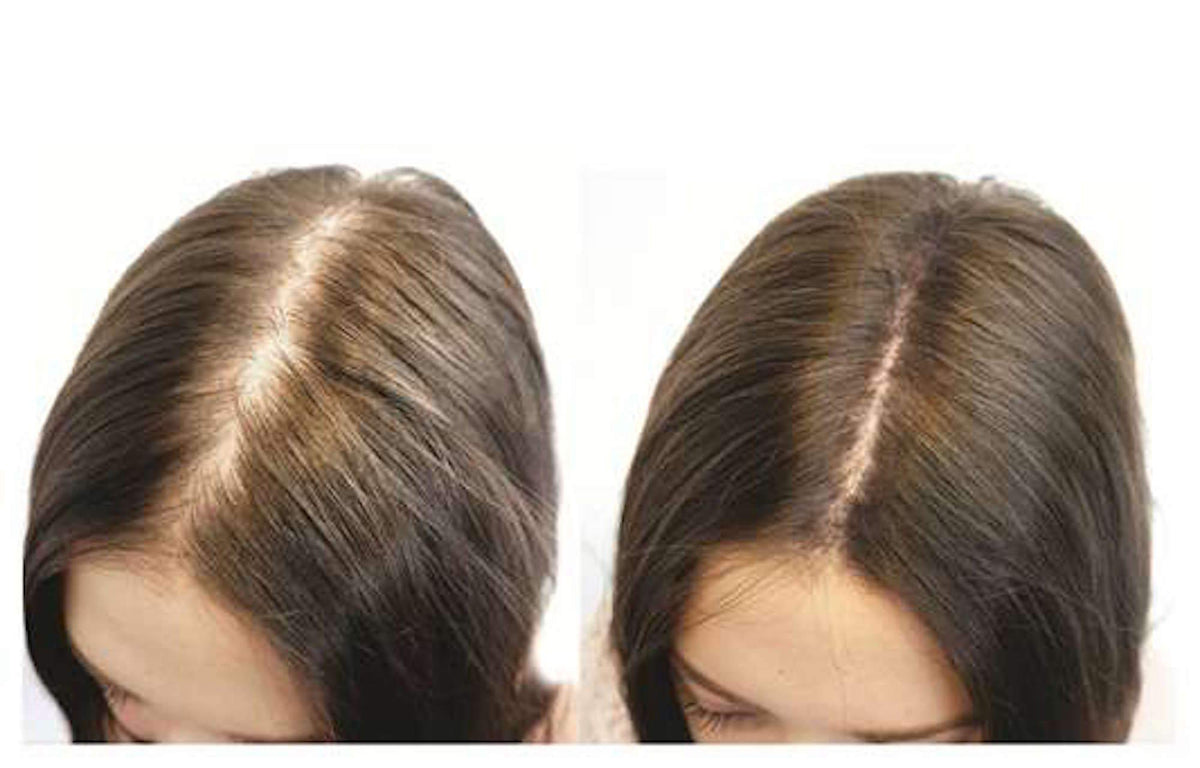 First Impressions Hair Fibres 100% Natural Keratin Hair Building Fibres - Refill For Hair Loss - Alopecia & Chemotherapy (50g, Dark Brown)