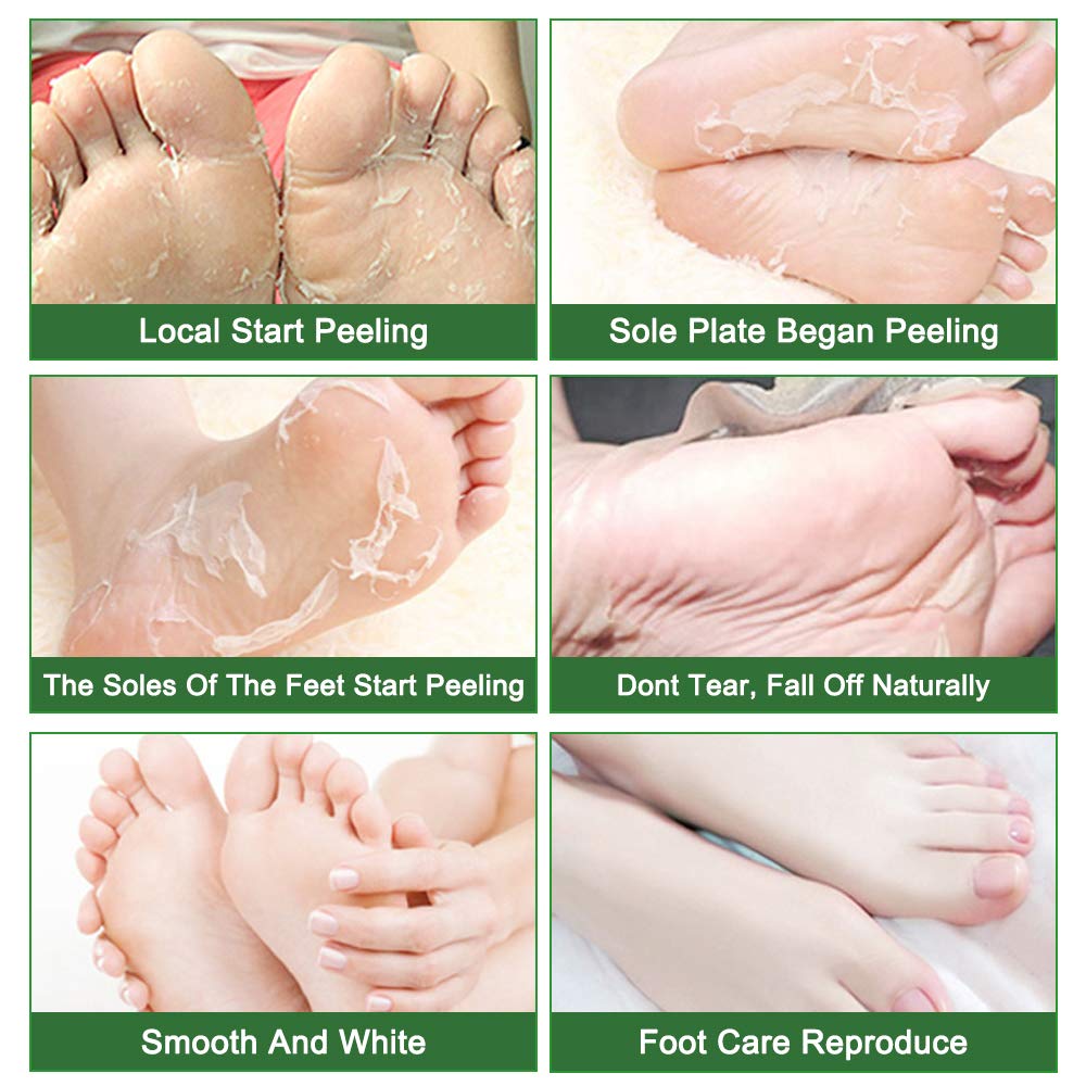 IDUCEN Foot Mask 2 Pack, (Tea Tree) Foot Peel Mask Callus Remover, Exfoliating Peeling Calluses Dead Skin, Callus Remover Foot Mask, Baby Soft Smooth Touch Feet-Men Women Exfoliating Foot Mask