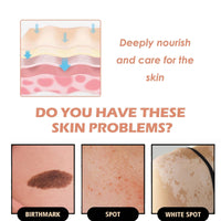 Oumun Colour Corrector Concealer,Leg Makeup Waterproof No Transfer,Leg Makeup Lotion,Leg Vein Cover up Makeup,Leg and Body Scar Cover up Makeup,Concealer Full Coverage,Makeup Concealer,Light Concealer,02#