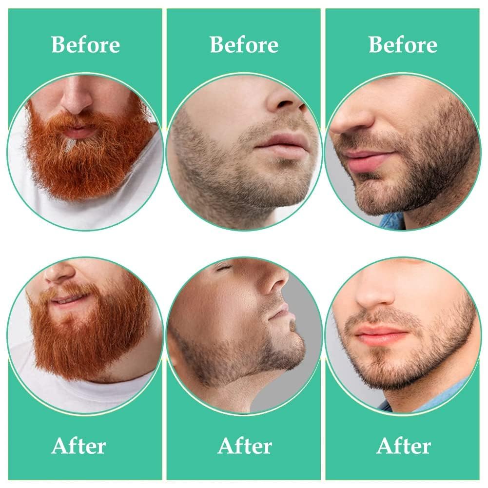 DreamAug 2PCS Beard Shaping Tool, Beard Shaper, Stencil Guide for Perfect Symmetric Lines & Trimming