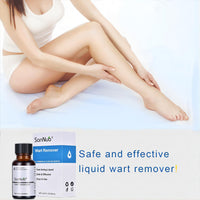 SANNUO Extra Strength Wart & Corn Remover, Fast Acting Gel Wart Removal for Plantar Wart Flat Warts and Corns for Feet Toes Finger and Hand, 0.67 FL OZ
