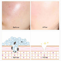 mercham 20 PCS Clay Mask, Deep Cleanse Mud Mask Set, Oil Control, Shrink Pores, Hydrating Clay Face Masks Gift, 100% Vegan Face Masks Skincare for All Skin Types 5g*20