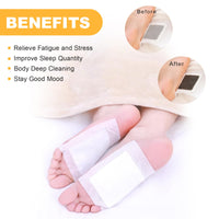 DRTRU 30pcs Ginger Detox Foot Pads - Anti-Swelling Ginger Detox Patches, Cleansing Foot Pads for Stress Relief & Better Sleep