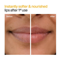 WishCare Ceramide Lip Balm with SPF50 PA+++ - Kojic Acid & Niacinamide - For Lip Lightening & Protection 5gm