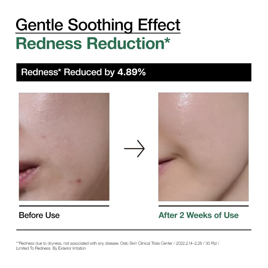 ANUA Anua Heartleaf 80 Soothing Ampoule, Hydration Facial Serum for Glass Skin, Panthenol, Hyaluronic Acid, Non-Greasy, Gentle Formula, Lightweight Essence, Vegan, Korean Skin Care, 30ml/1.01 fl.oz