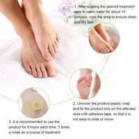 Cherioll Wart Remover, Wart Remover Pads, 50pcsWart Treatment, Wart Remover for Hands, Feet, Feet Callus Remove, Verruca and Wart, Relief Pain Removal Warts Plaster, Soften Skin Cutting Sticker Toe Protector